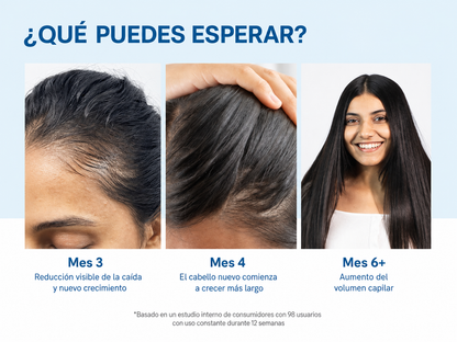 SERUM CRECIMIENTO DE CABELLO BODY WISE + ENVÍO GRATIS