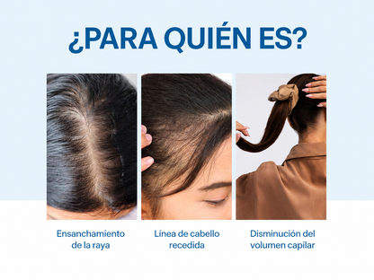SERUM CRECIMIENTO DE CABELLO BODY WISE + ENVÍO GRATIS